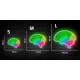 Neón cerebro